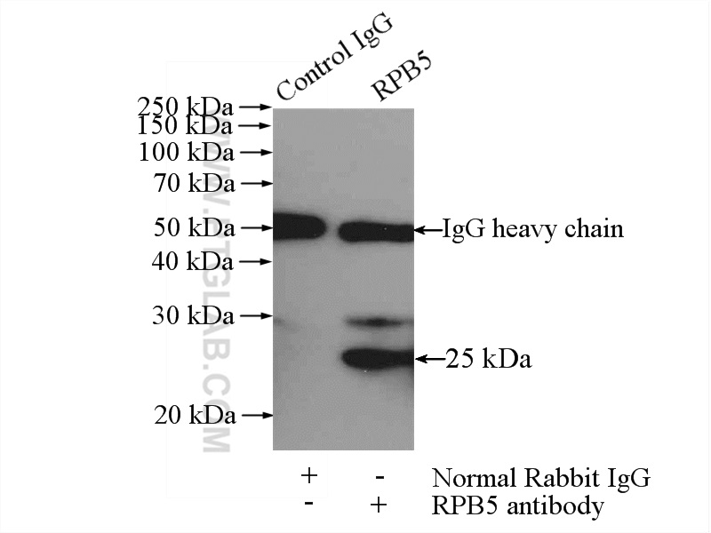 IP experiment of HeLa using 15217-1-AP