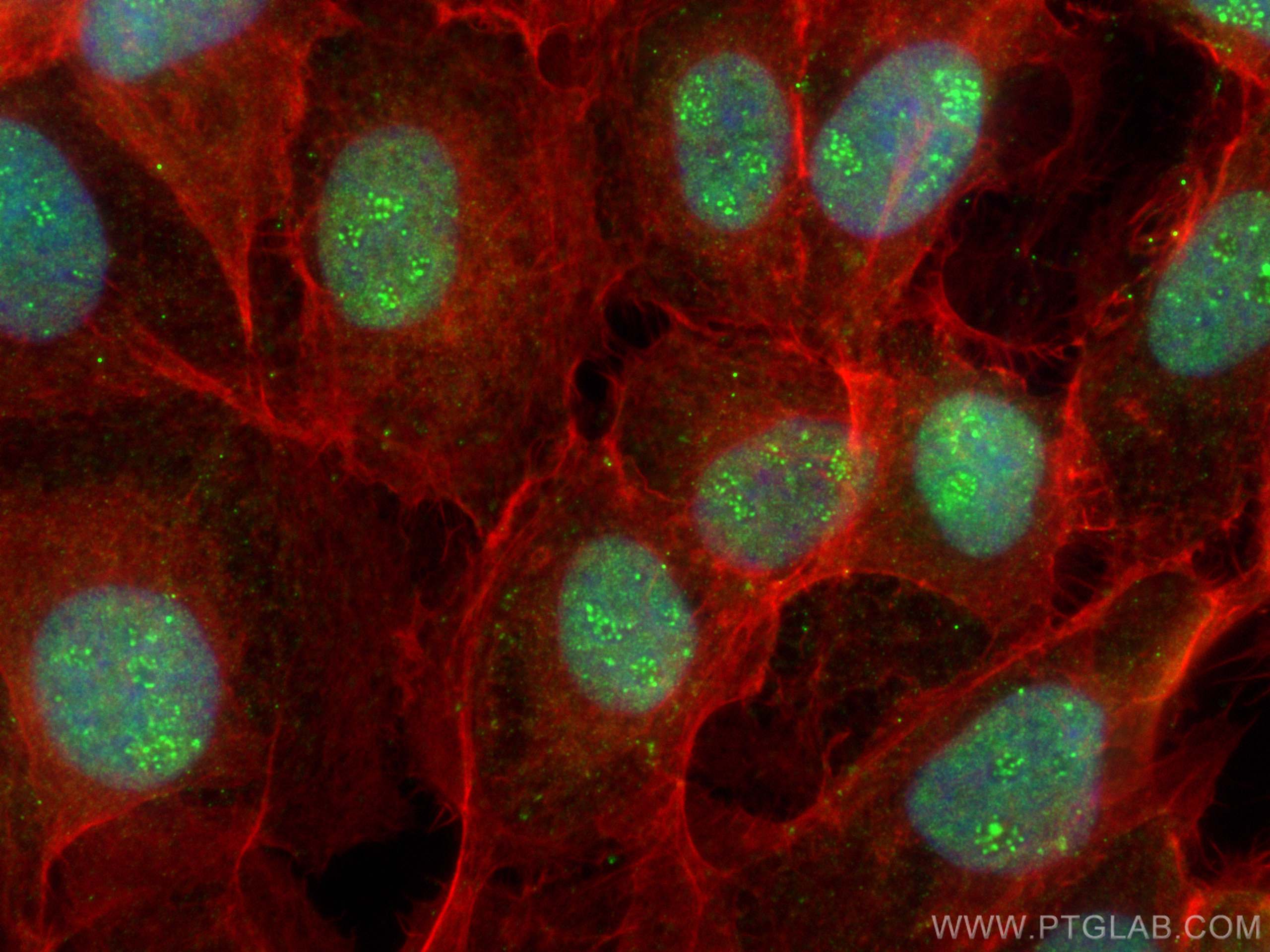 IF Staining of A431 using 15334-1-AP