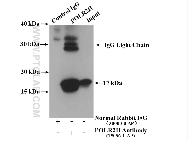 IP experiment of mouse liver using 15086-1-AP