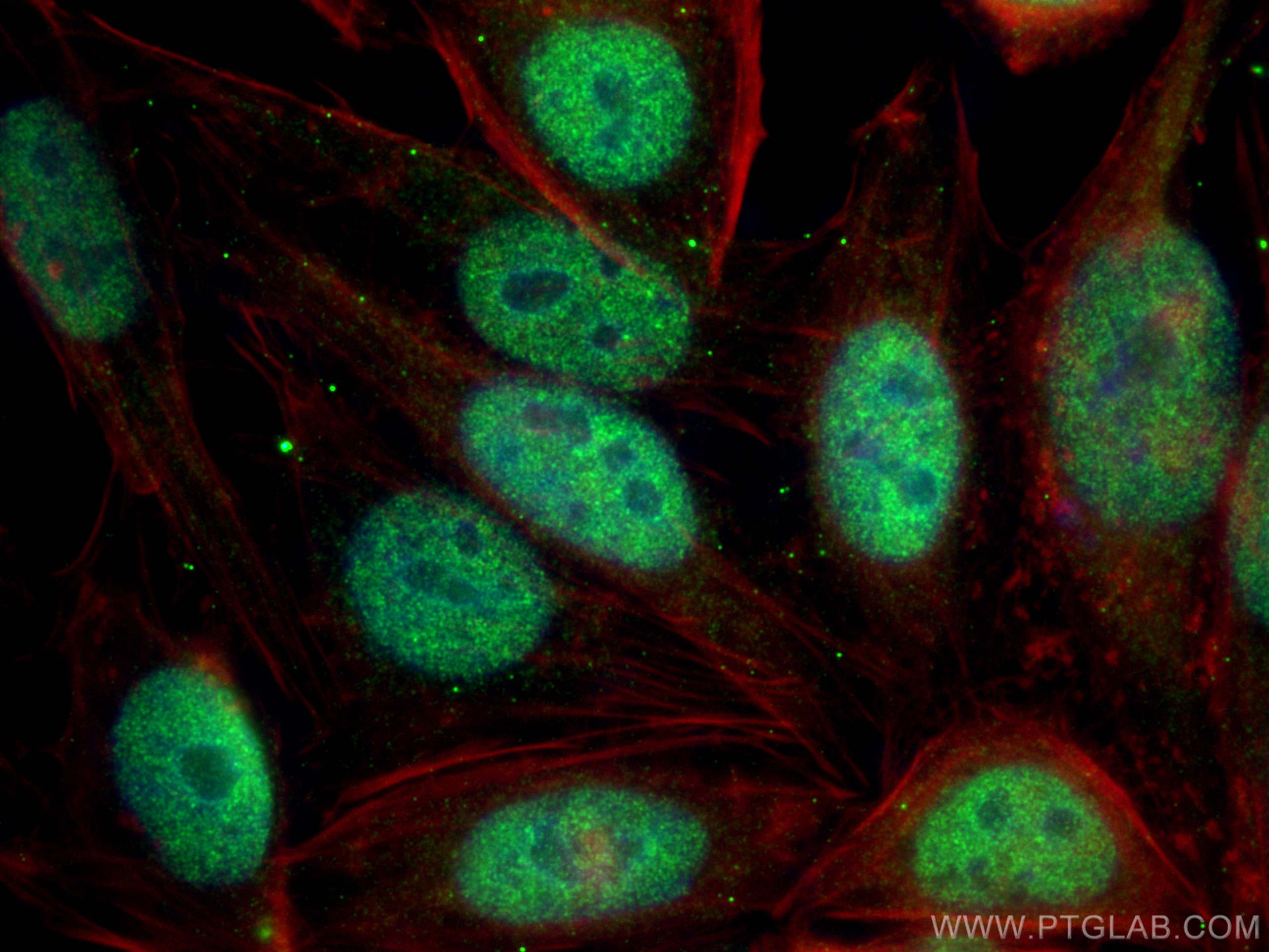 IF Staining of HepG2 using 17270-1-AP