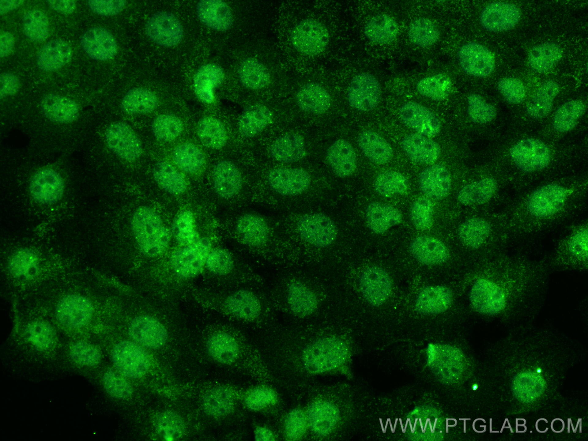 IF Staining of A431 using 28842-1-AP