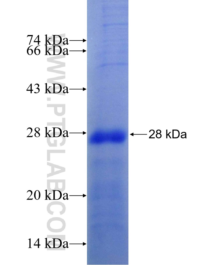 POLR3A fusion protein Ag29036 SDS-PAGE