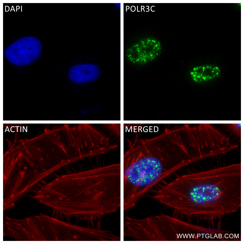 IF Staining of HeLa using 84367-7-RR (same clone as 84367-7-PBS)