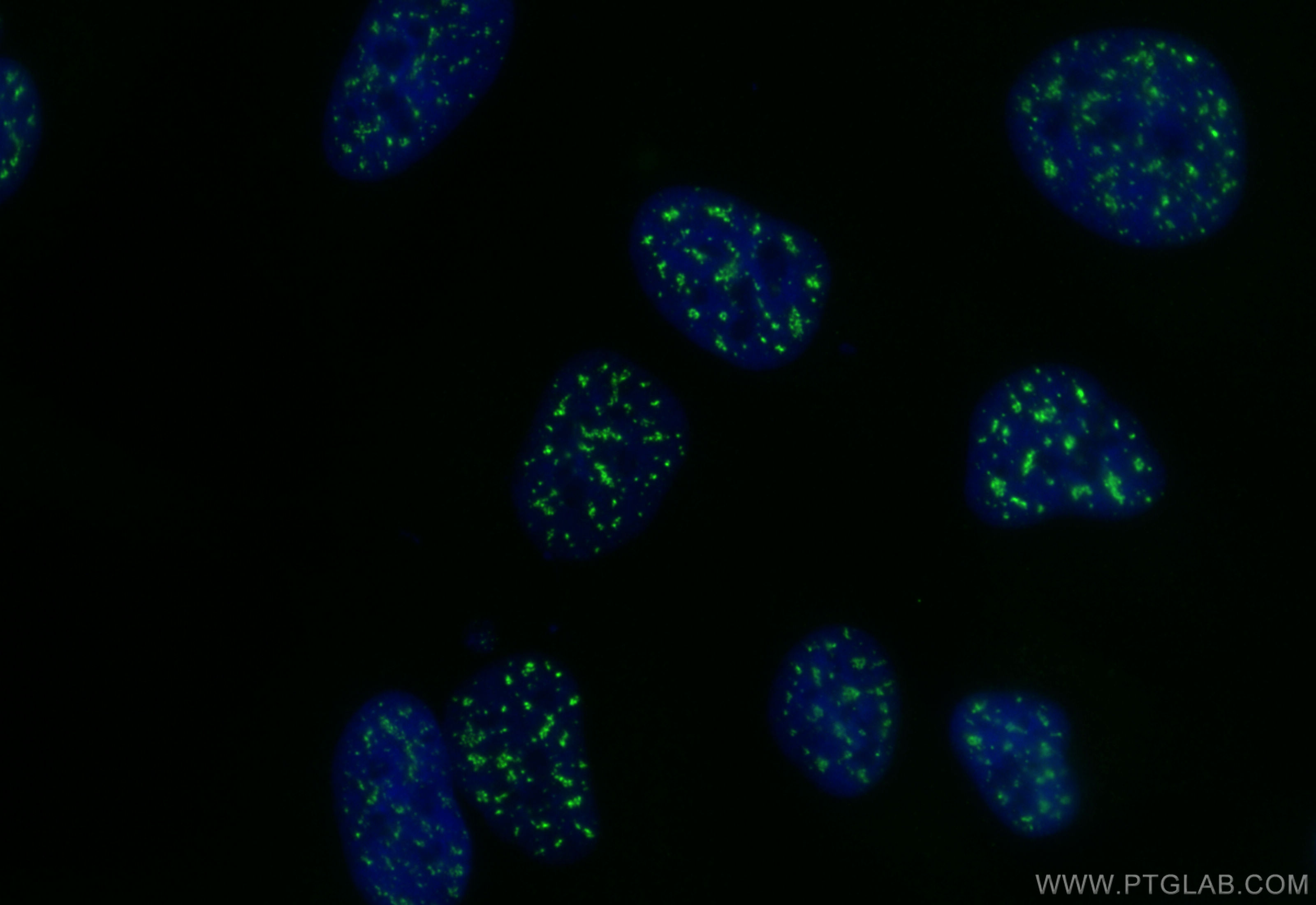 IF Staining of Hela using CL488-84367-7