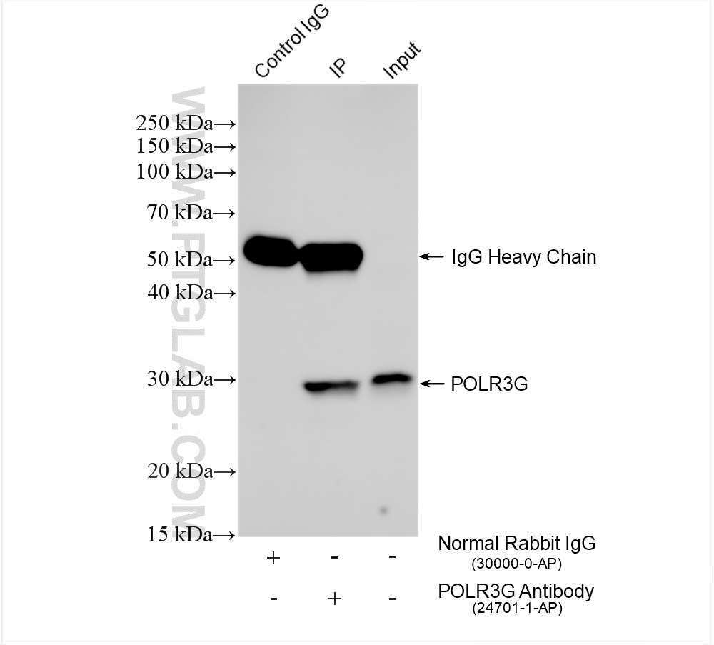 IP experiment of HeLa using 24701-1-AP