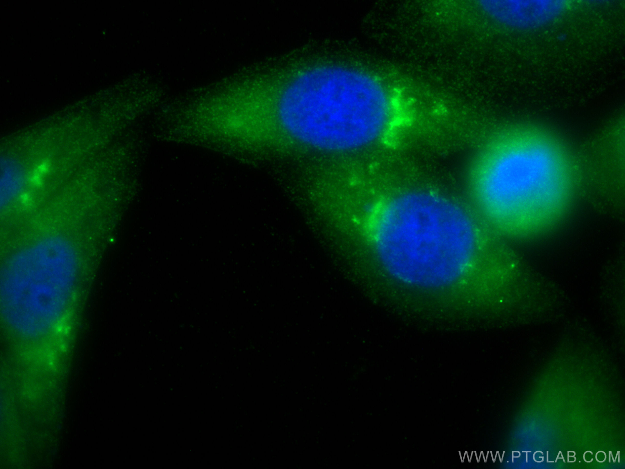 IF Staining of HepG2 using 15046-1-AP