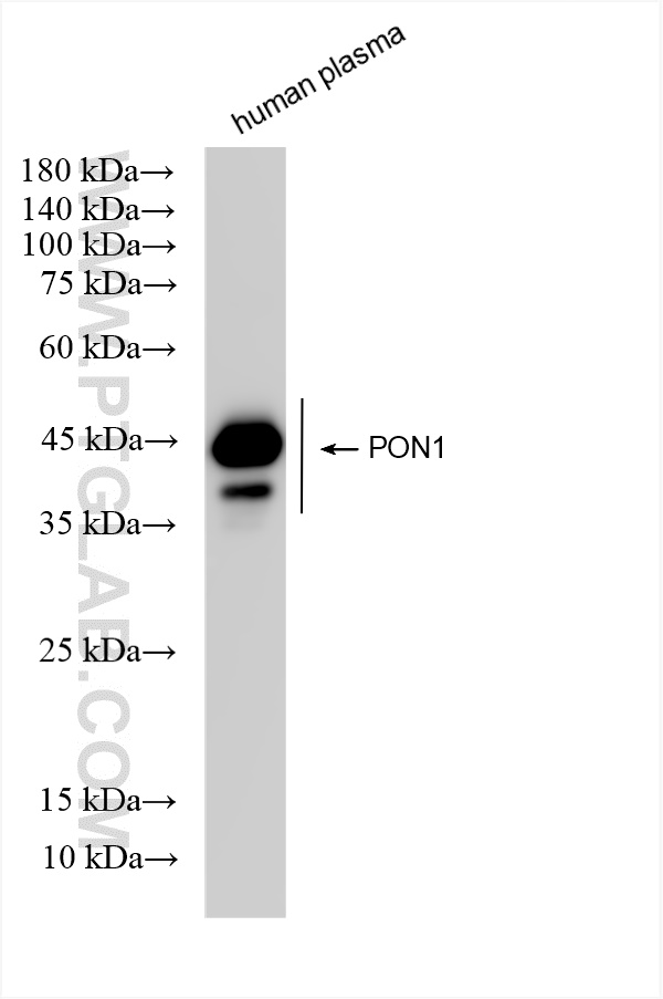 WB analysis using 83982-2-RR (same clone as 83982-2-PBS)