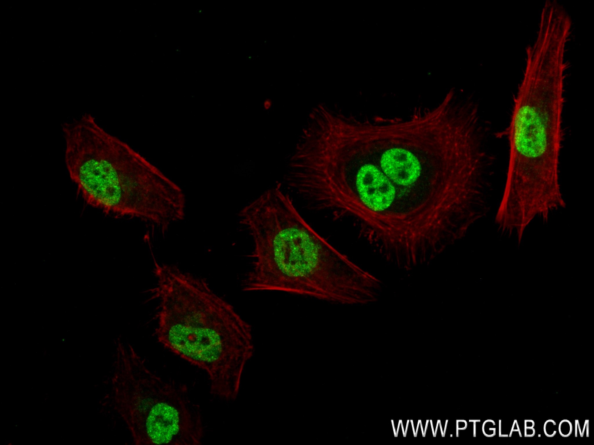 IF Staining of HeLa using 83732-2-RR (same clone as 83732-2-PBS)