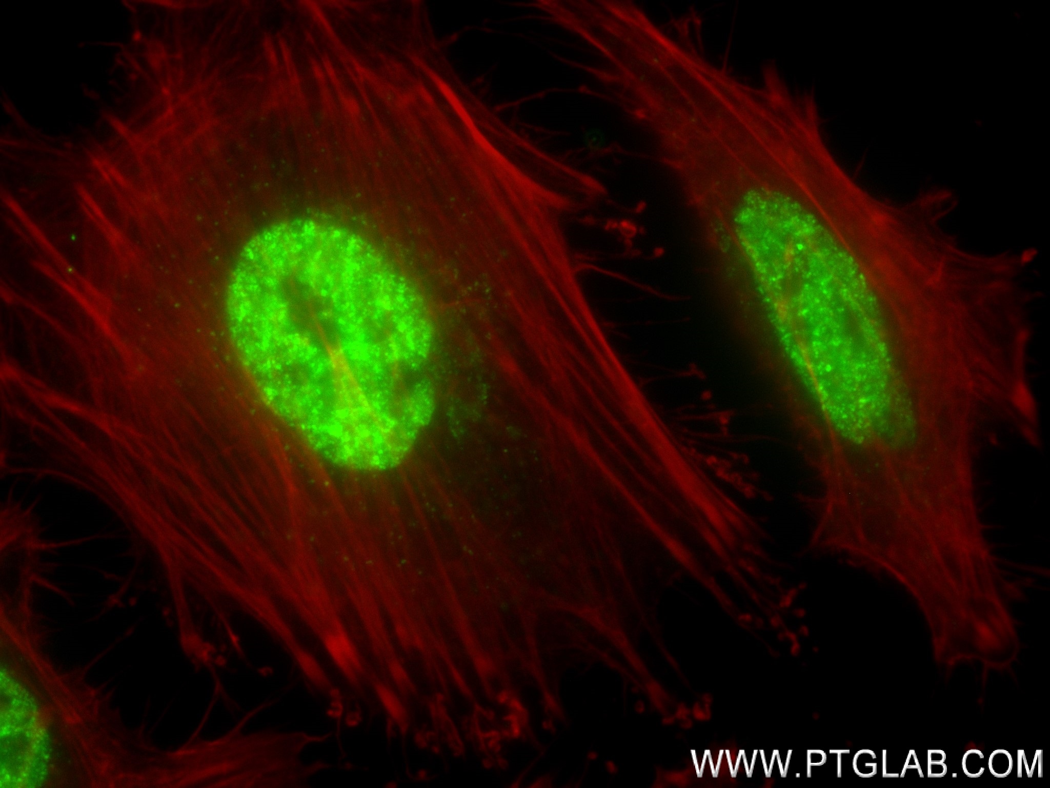 IF Staining of HeLa using 83732-2-RR (same clone as 83732-2-PBS)