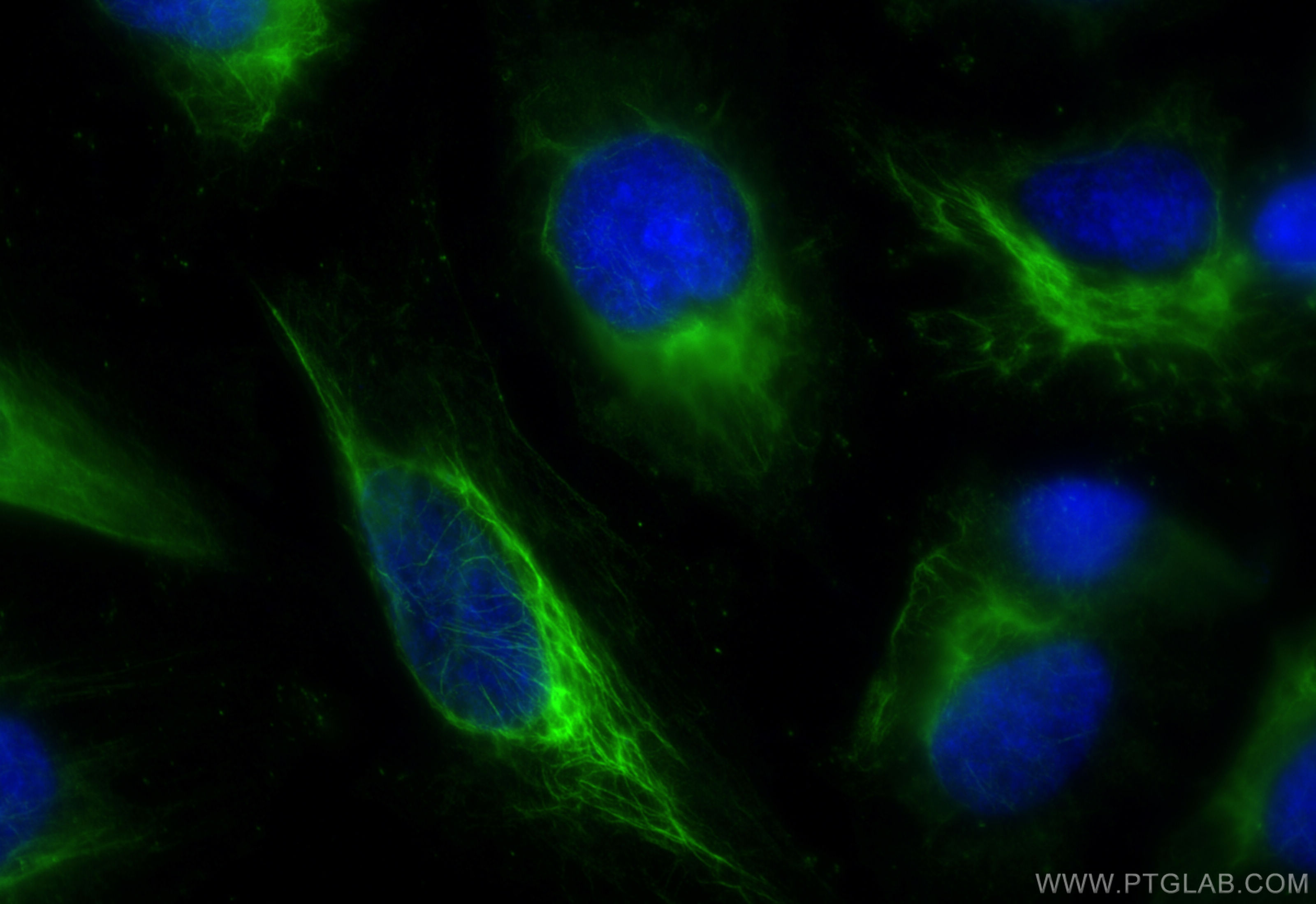 IF Staining of HeLa using 84298-1-RR (same clone as 84298-1-PBS)