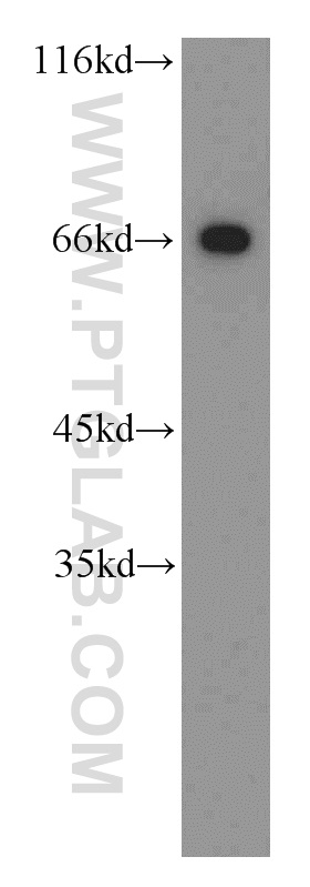 WB analysis of mouse testis using 20206-1-AP