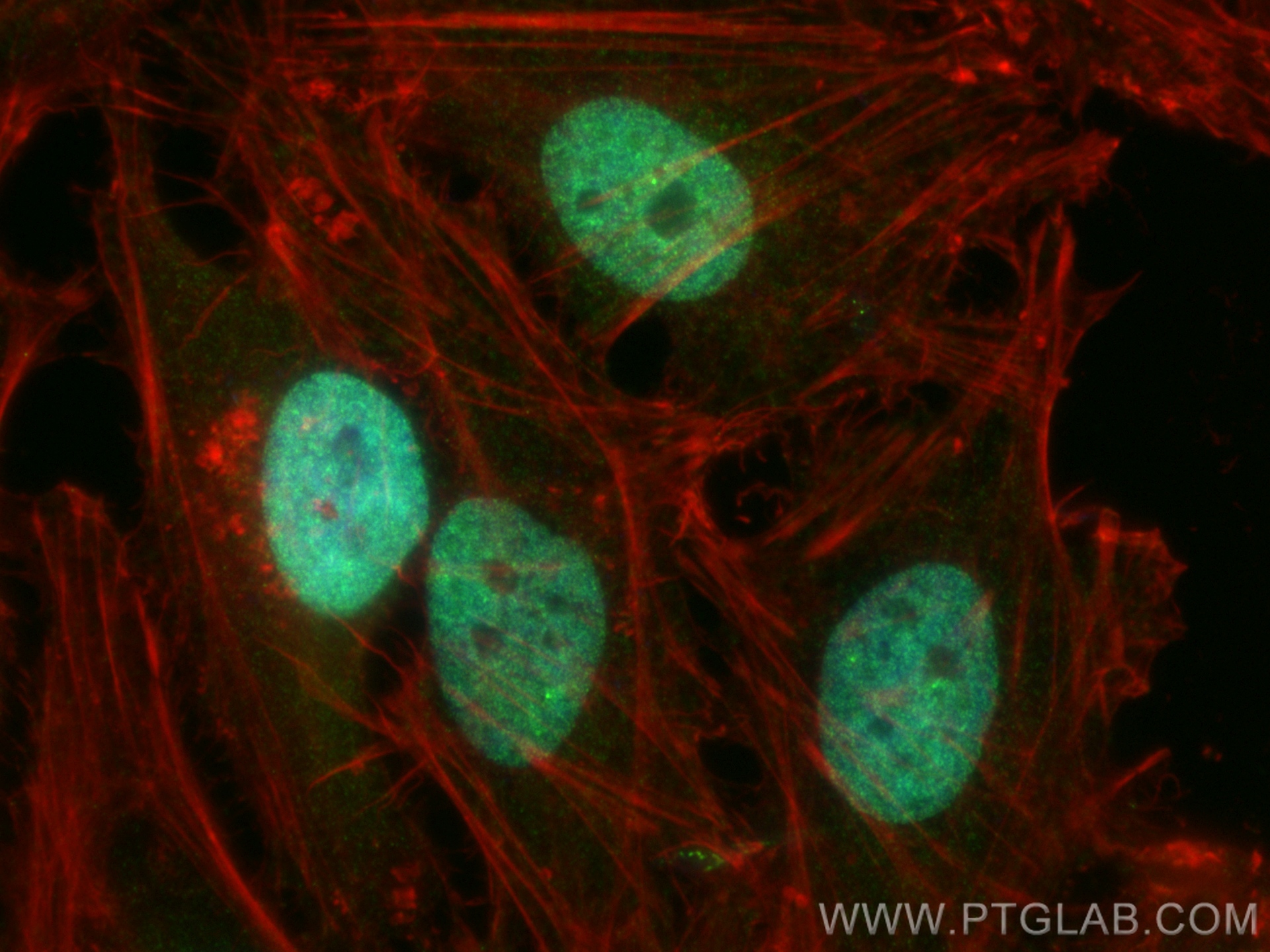 IF Staining of HeLa using 10387-1-AP