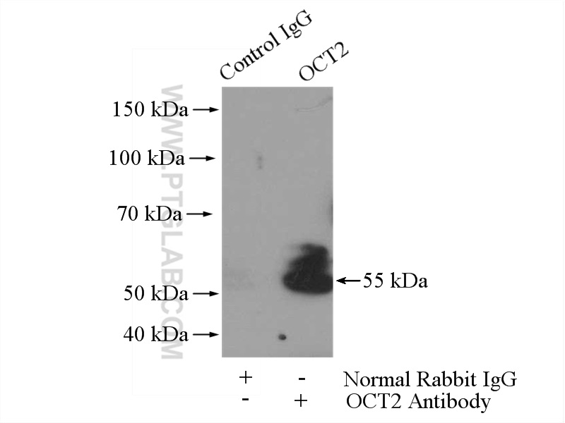 IP experiment of NIH/3T3 using 10867-2-AP