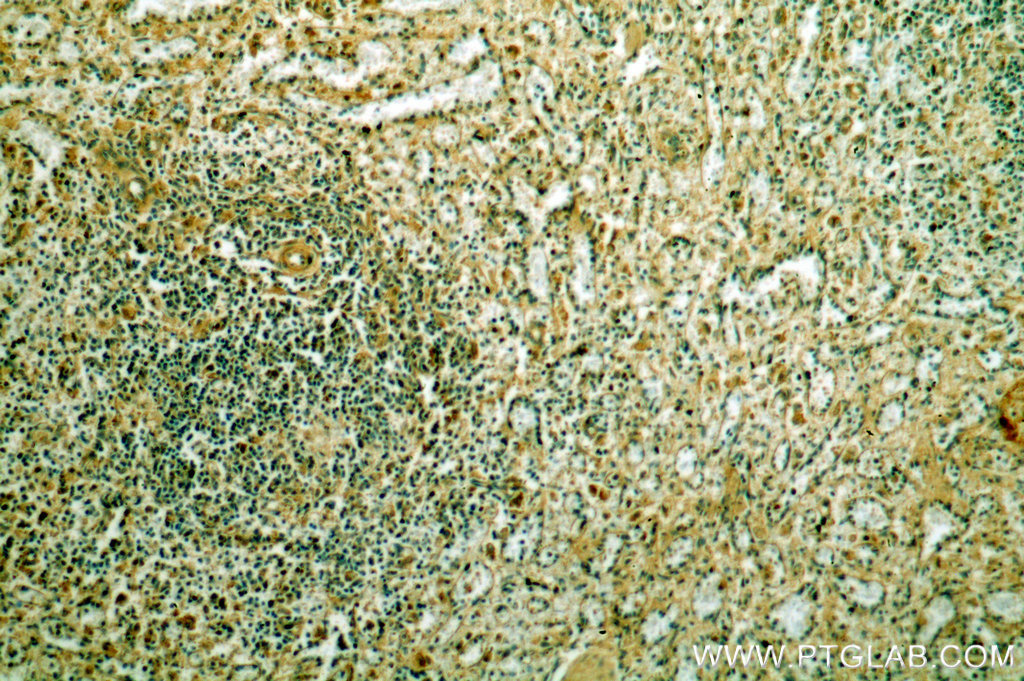 IHC staining of human spleen using 18996-1-AP