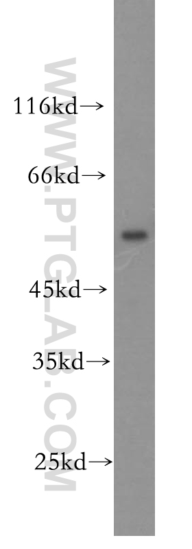 WB analysis of mouse thymus using 18996-1-AP