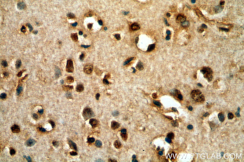 IHC staining of human brain using 18999-1-AP