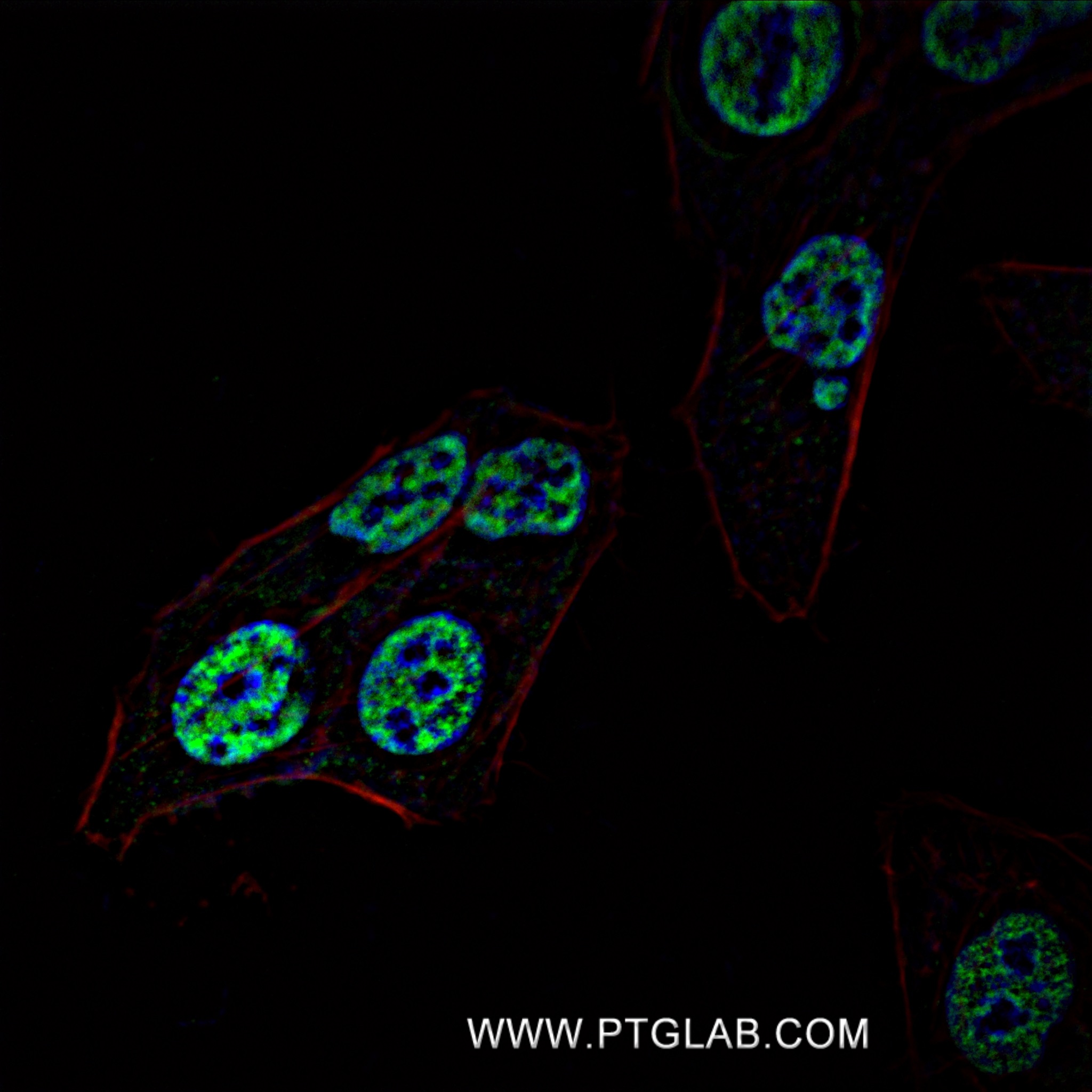 IF Staining of U2OS using 82980-1-RR (same clone as 82980-1-PBS)