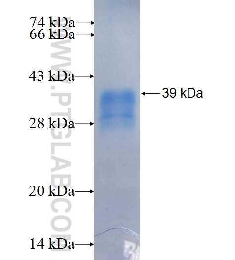 PPAP2B fusion protein Ag26422 SDS-PAGE