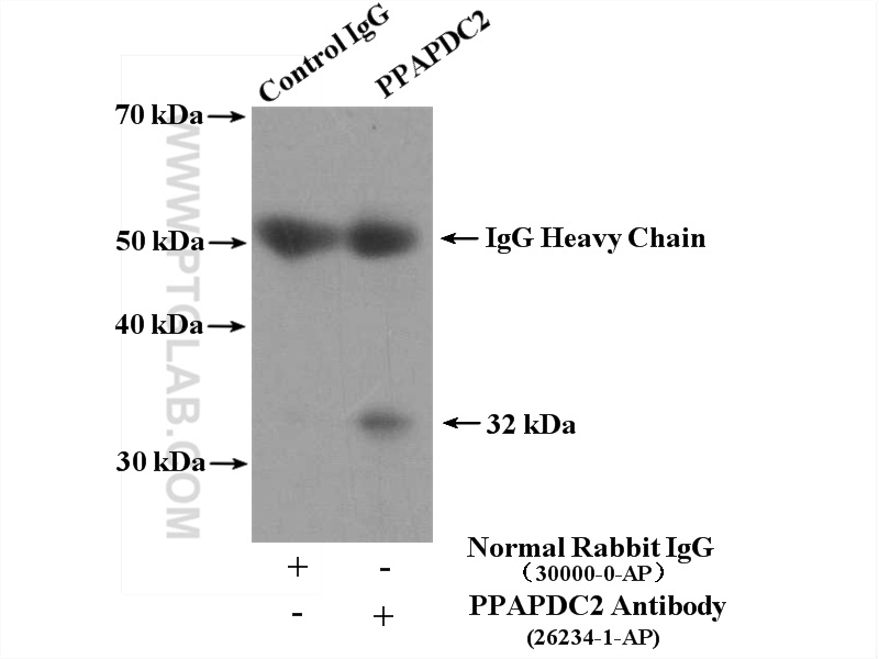 IP experiment of HepG2 using 26234-1-AP