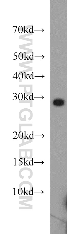 WB analysis of mouse skeletal muscle using 20635-1-AP