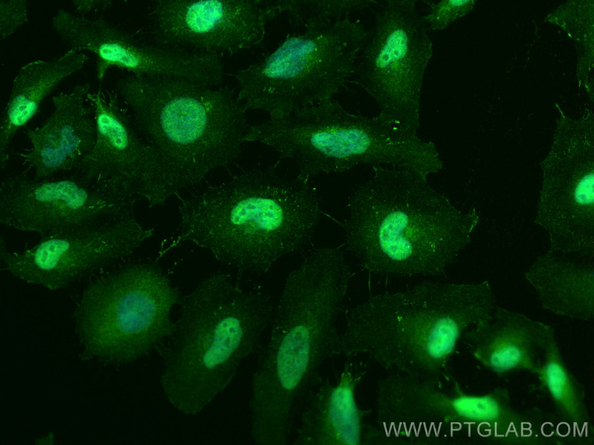 IF Staining of HeLa using 60127-1-Ig