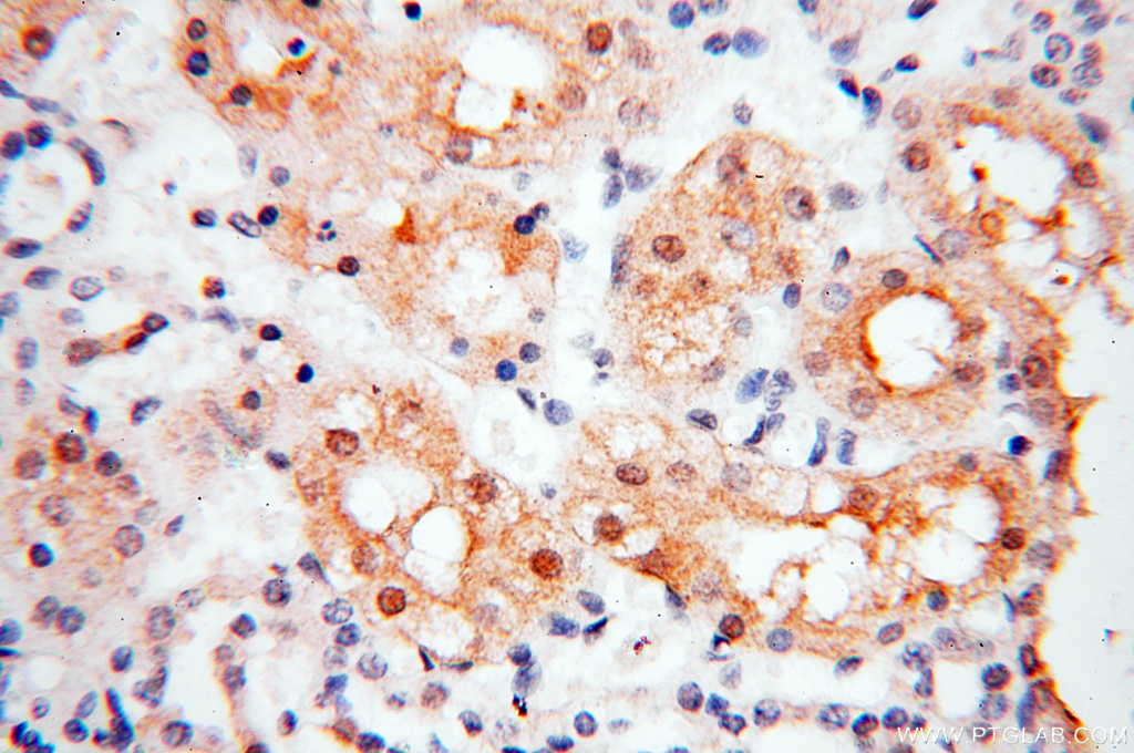 IHC staining of human kidney using 18001-1-AP