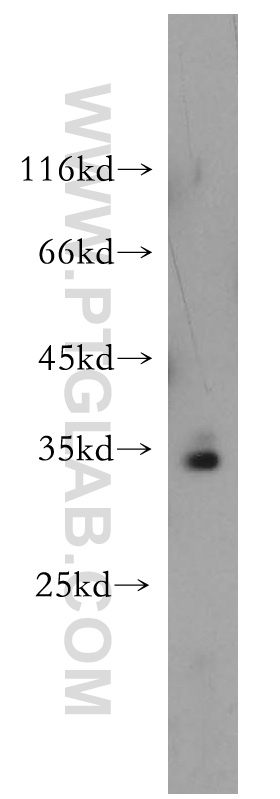 WB analysis of HeLa using 18001-1-AP