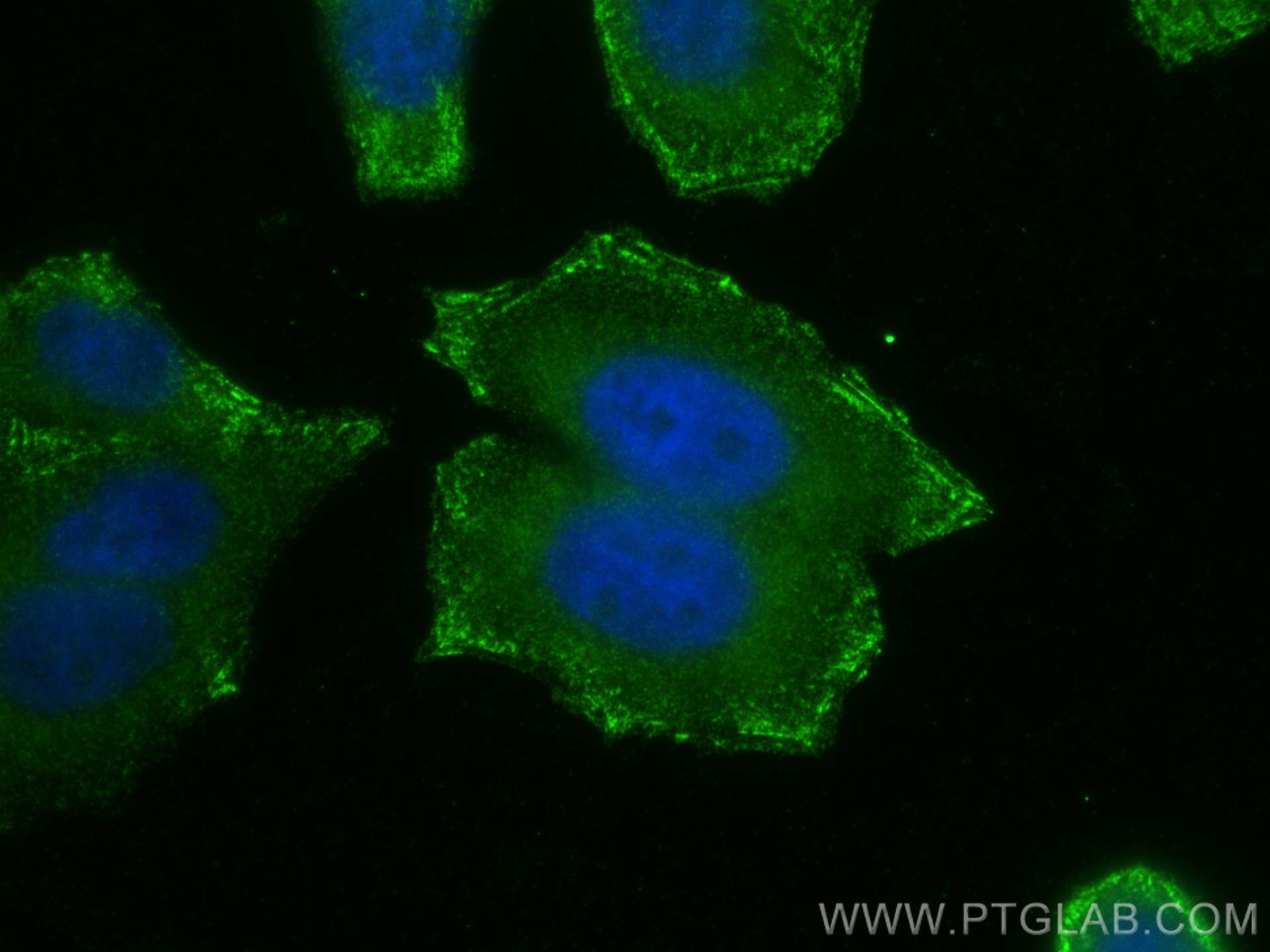 IF Staining of HepG2 using 14175-1-AP