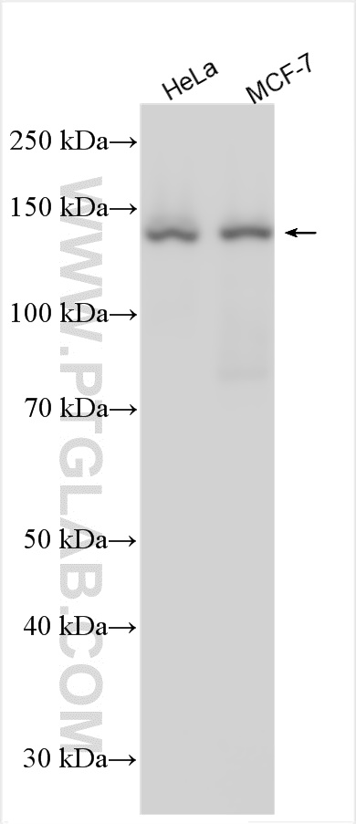 WB analysis using 14175-1-AP