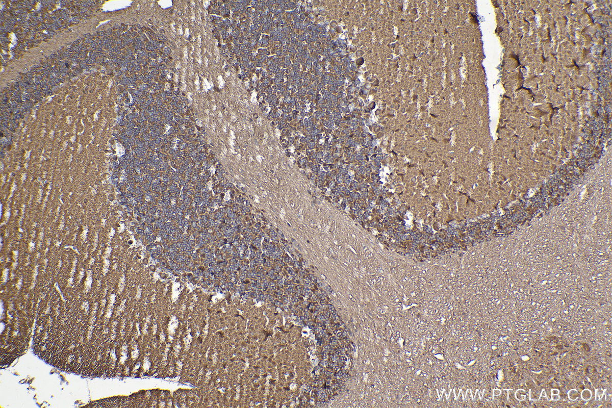 IHC staining of mouse cerebellum using 11492-1-AP