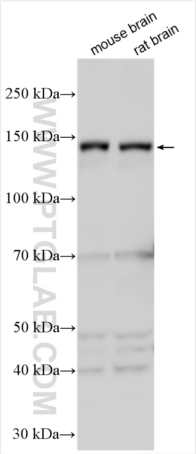 WB analysis using 11492-1-AP