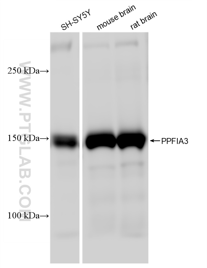 WB analysis using 83142-4-RR (same clone as 83142-4-PBS)