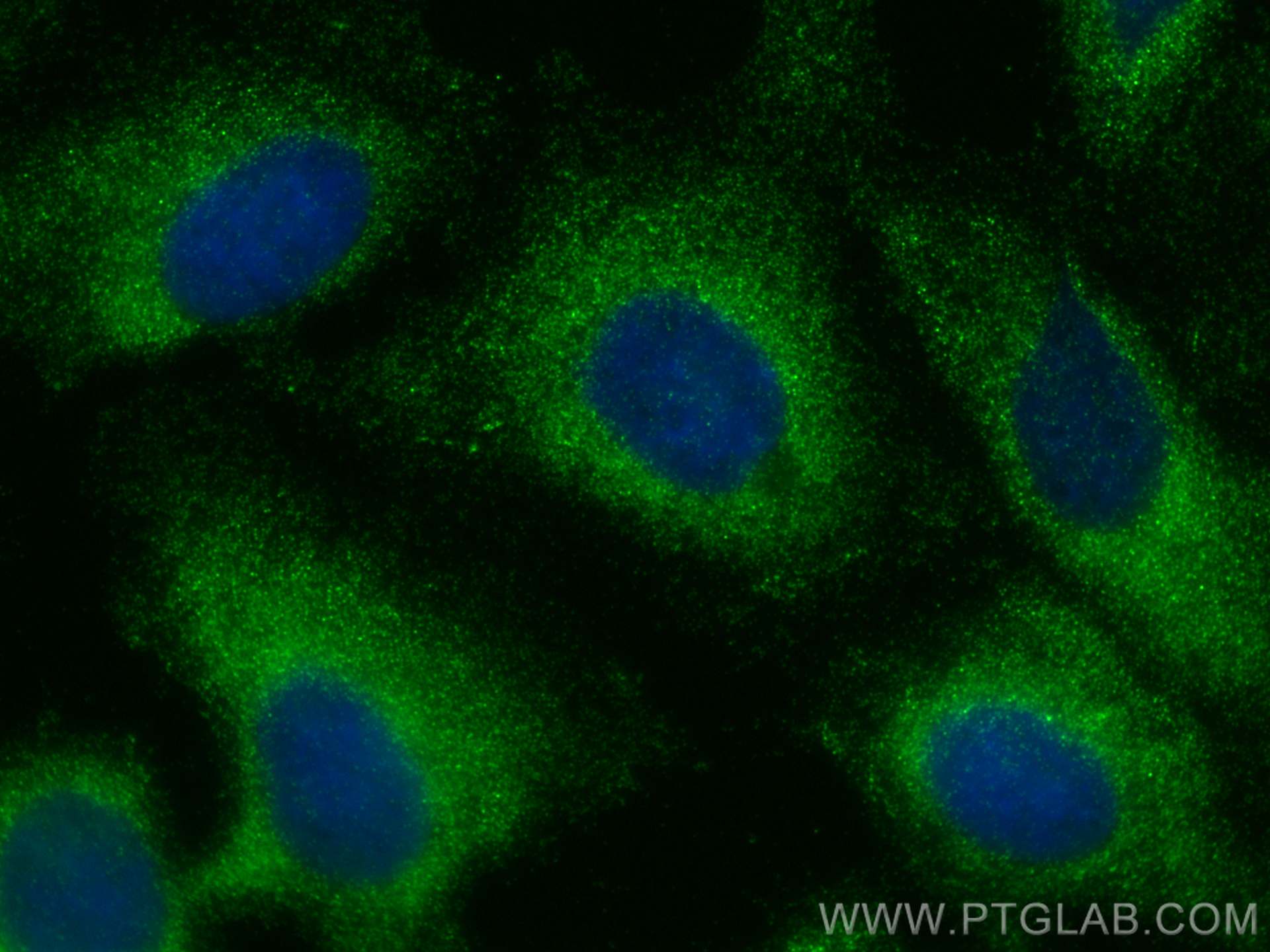 IF Staining of U2OS using 13961-1-AP