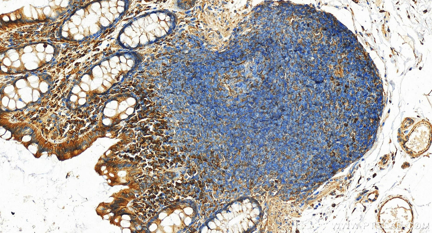 IHC staining of human normal colon using 11607-1-AP