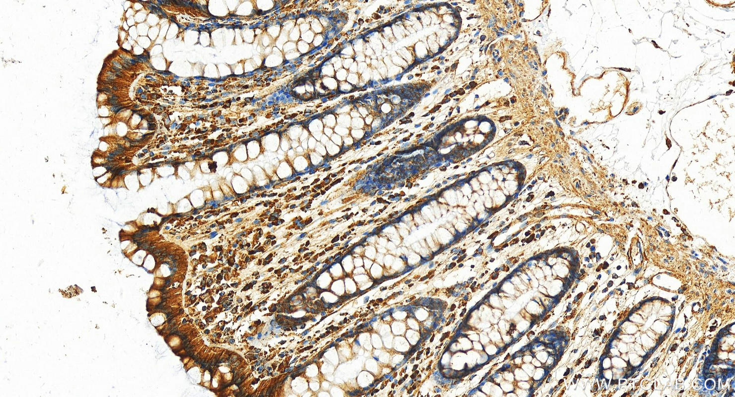 IHC staining of human normal colon using 11607-1-AP