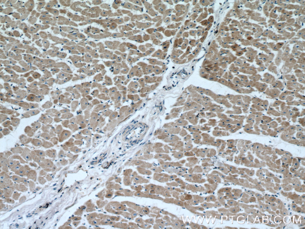 IHC staining of human heart using 18466-1-AP