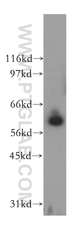 WB analysis of human kidney using 12590-2-AP