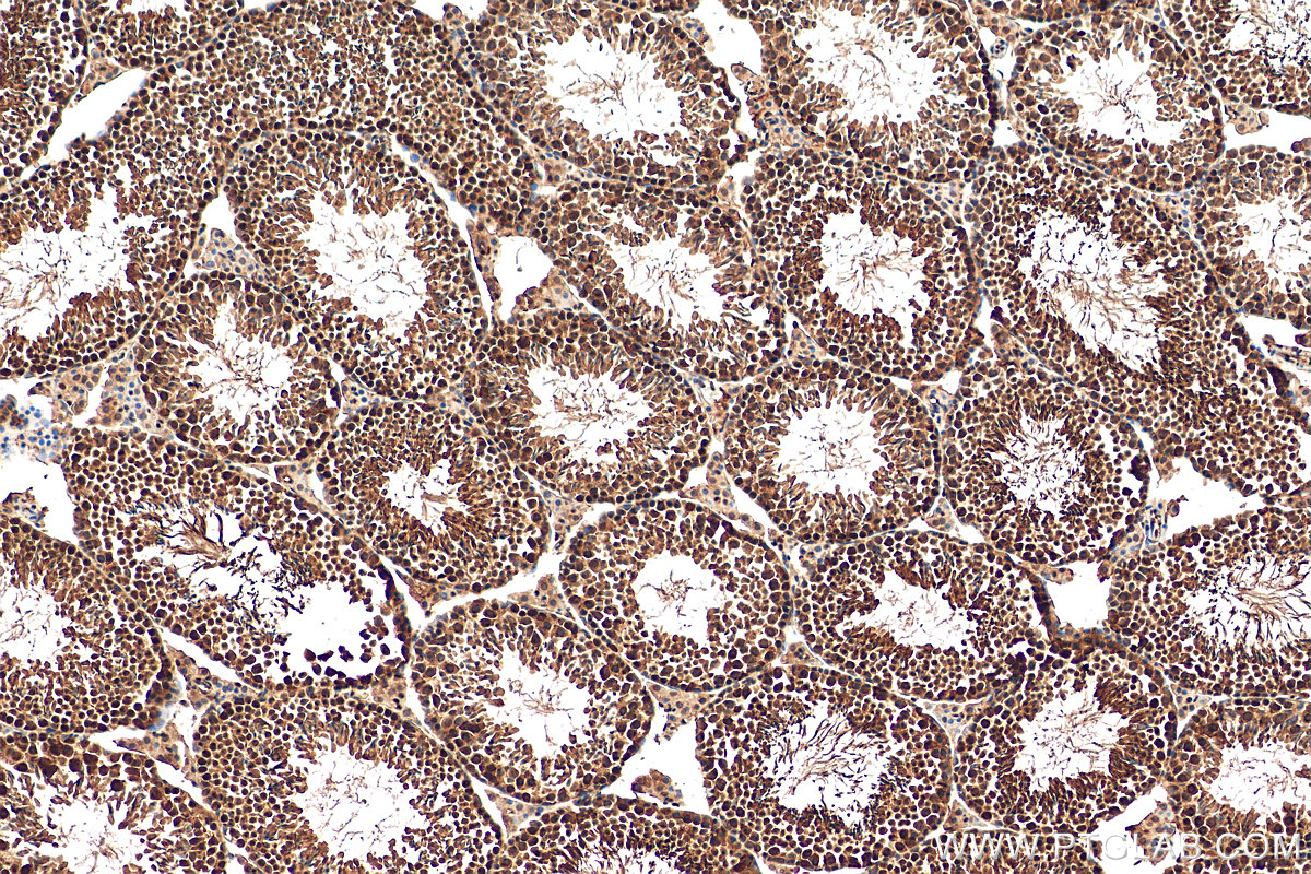 IHC staining of mouse testis using 15532-1-AP