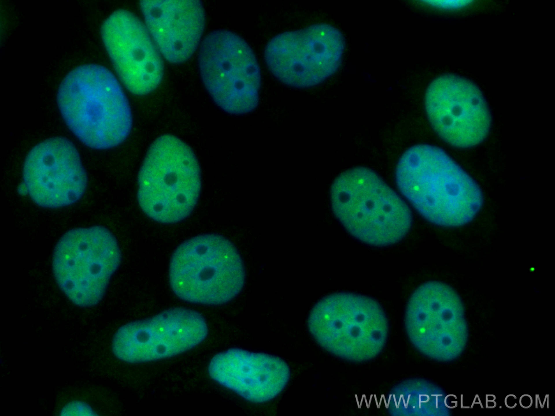 IF Staining of MCF-7 using CL488-15532