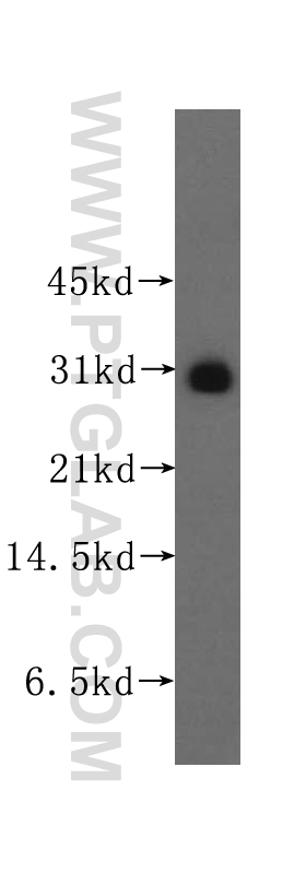 WB analysis of human lung using 12104-1-AP