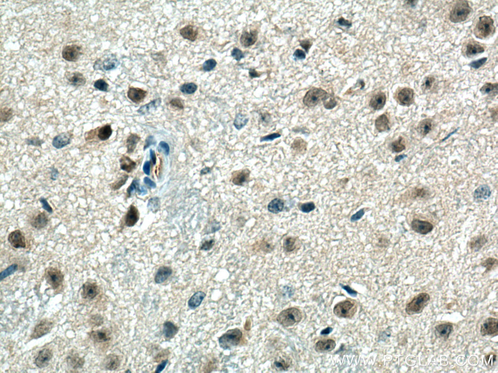 IHC staining of mouse brain using 14435-1-AP