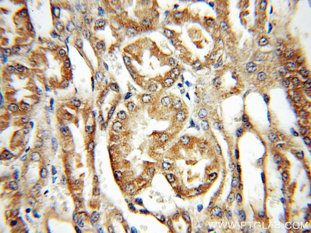 IHC staining of human kidney using 14870-1-AP