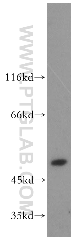 WB analysis of human placenta using 14870-1-AP