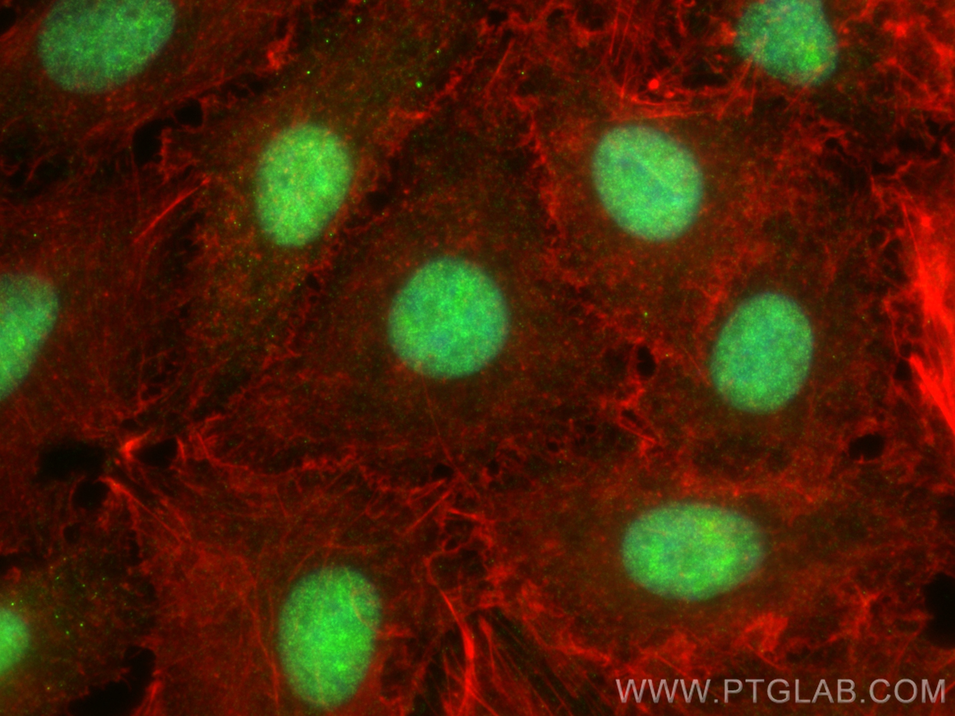 IF Staining of A549 using 11658-1-AP