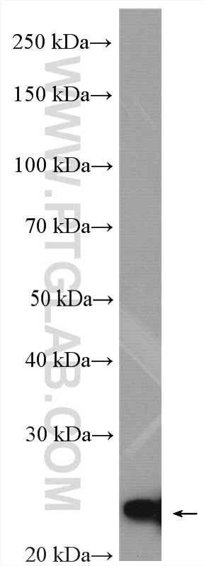 WB analysis of MCF-7 using 18476-1-AP