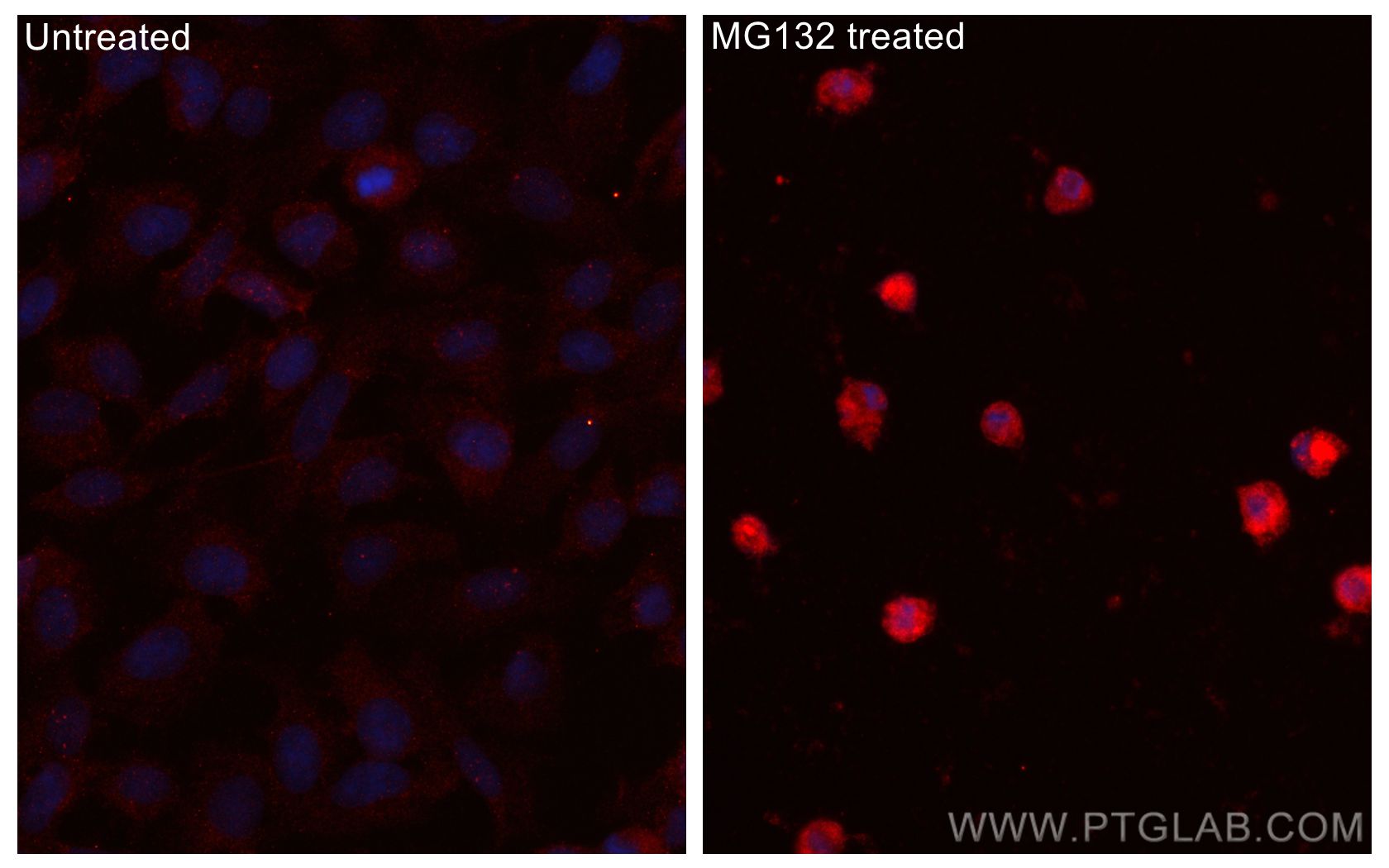 IF Staining of U2OS using 10449-1-AP