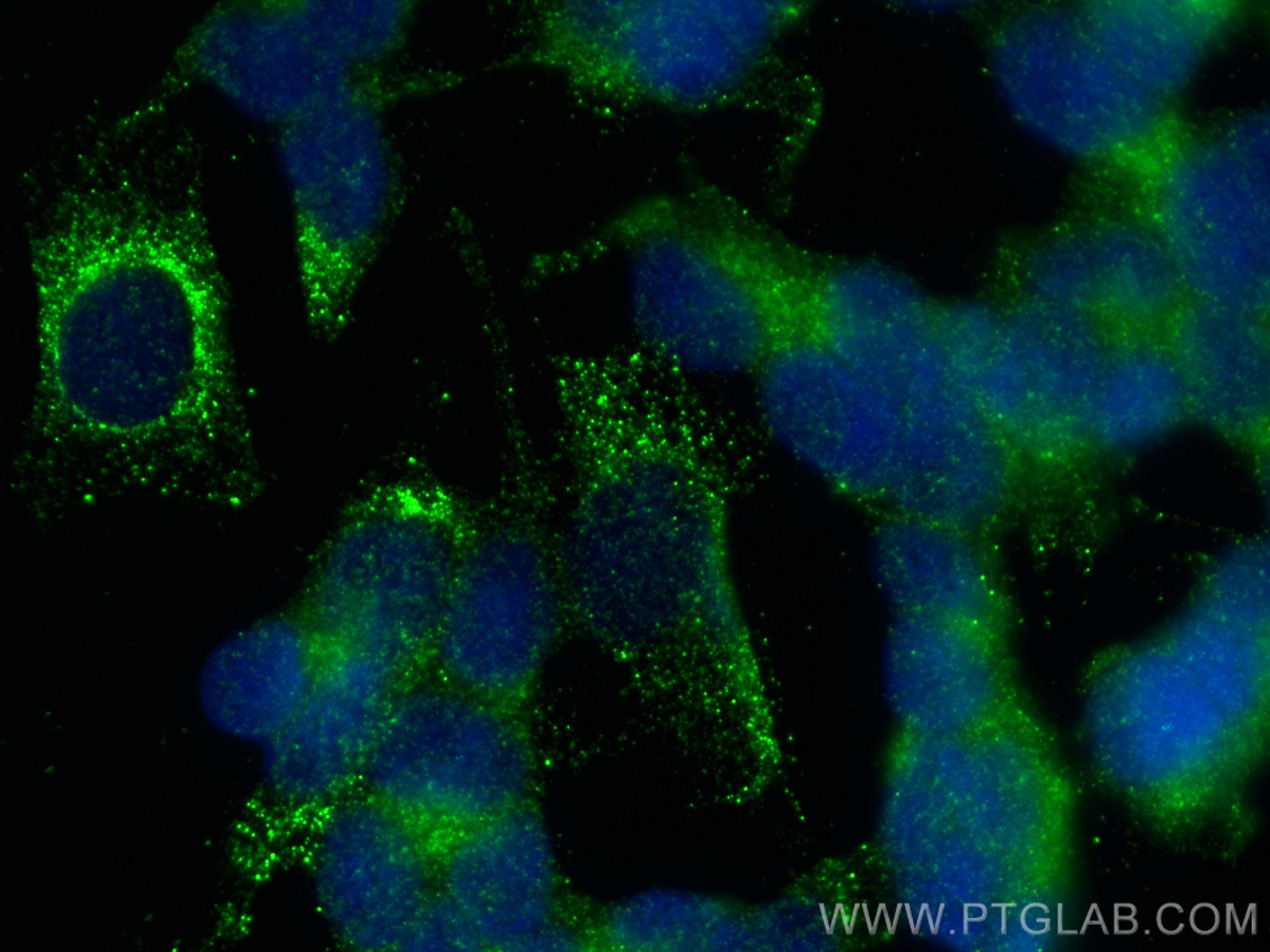 IF Staining of SH-SY5Y using 10748-1-AP