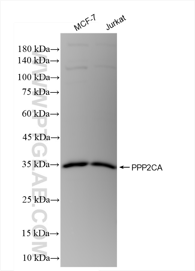 PPP2CA