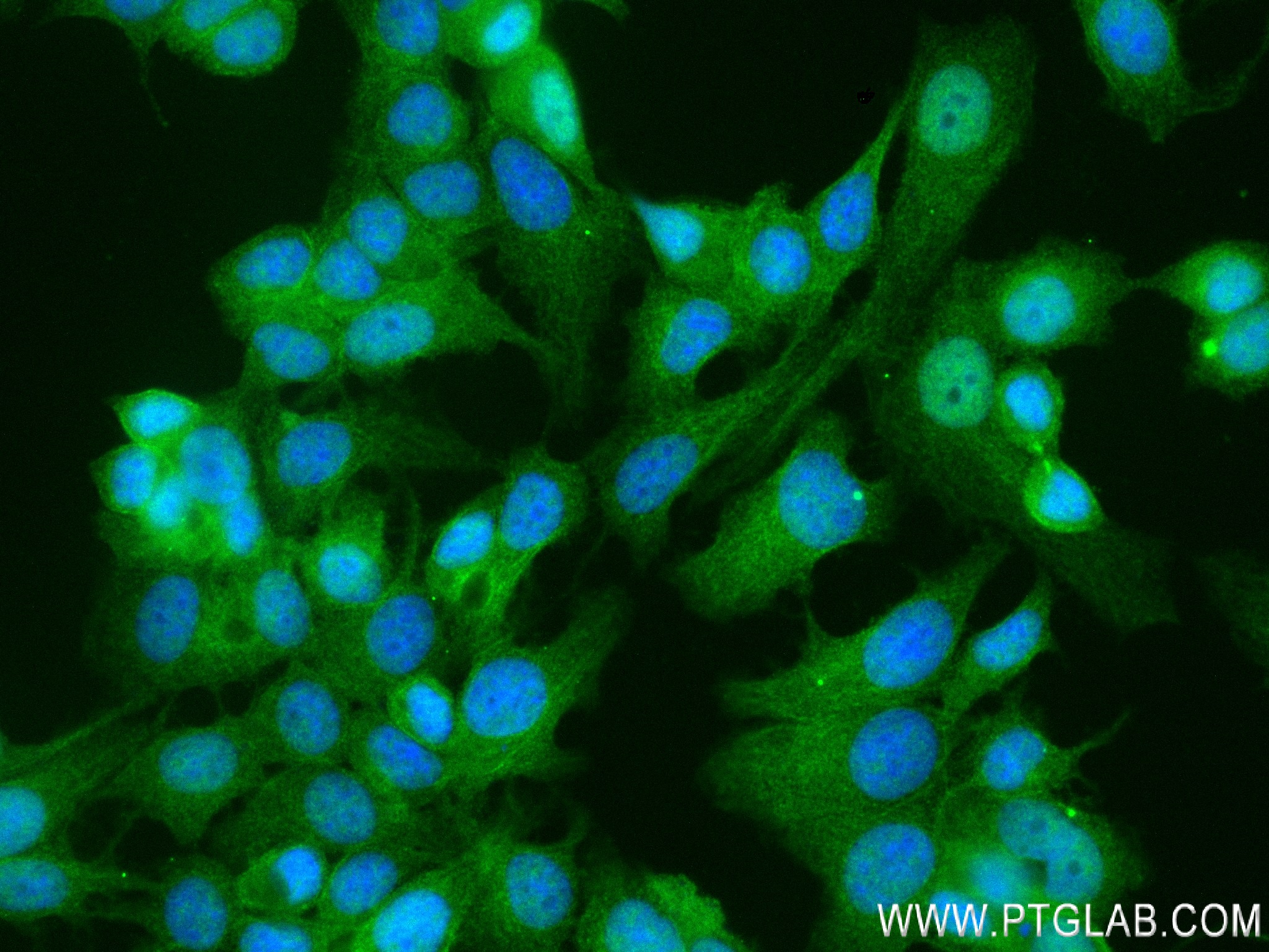 IF Staining of MCF-7 using 84155-6-RR