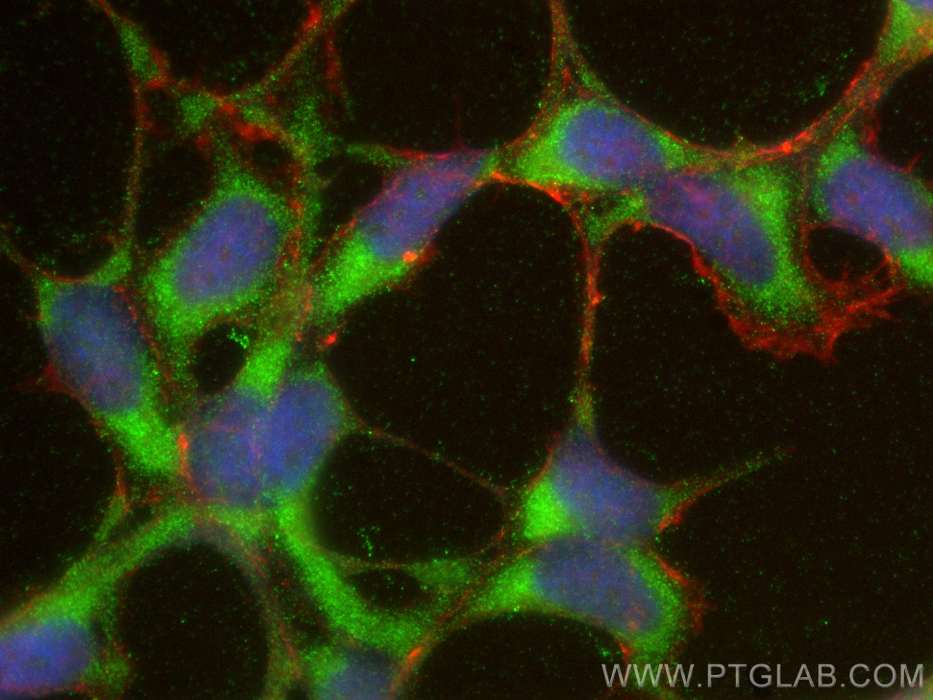 IF Staining of HEK-293 using 15882-1-AP